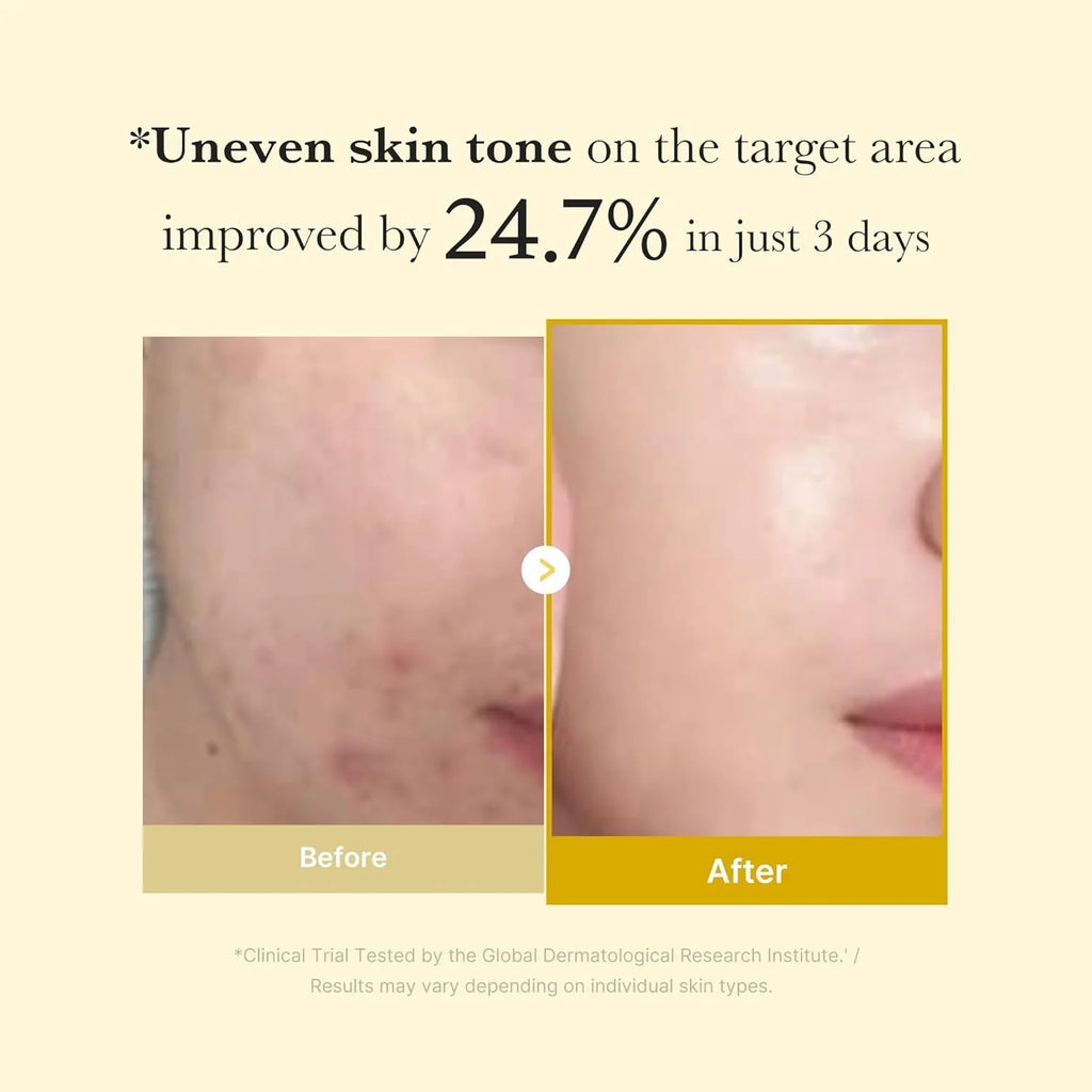 Medicube Kojic Acid Turmeric Night Wrapping Mask – Overnight Brightening & Hydrating Mask with Vitamin C, Retinol & Collagen (75 ml)