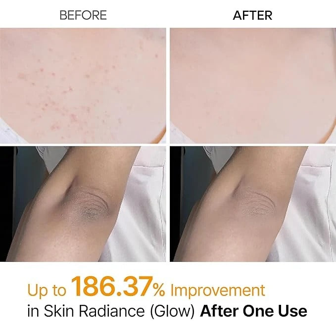 Dr.Melaxin Kojic Acid & Turmeric Body & Foot Peel Spray – 200ml